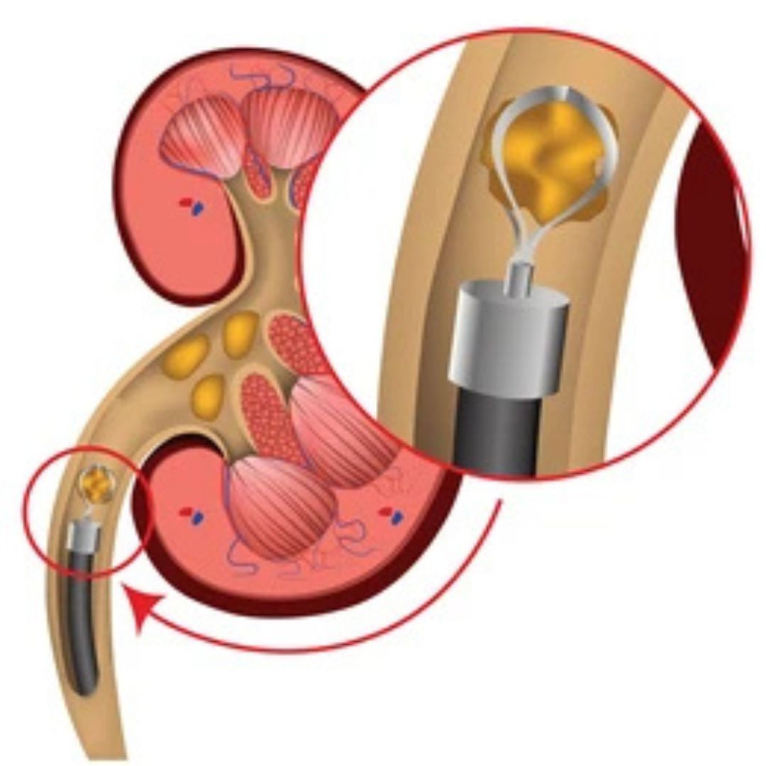 Best Urology Hospital in Shahibaug

